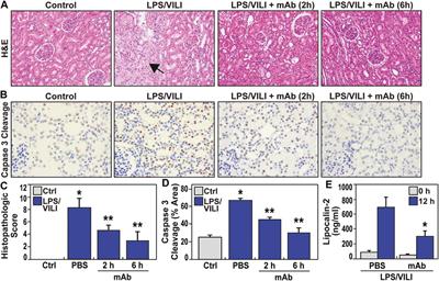 eNAMPT Neutralization Preserves Lung Fluid Balance and Reduces Acute Renal Injury in Porcine Sepsis/VILI-Induced Inflammatory Lung Injury